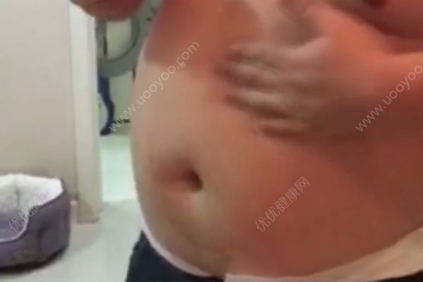 “一抹瘦”真的抹一下就瘦？这种产品并没有燃脂功效(1)