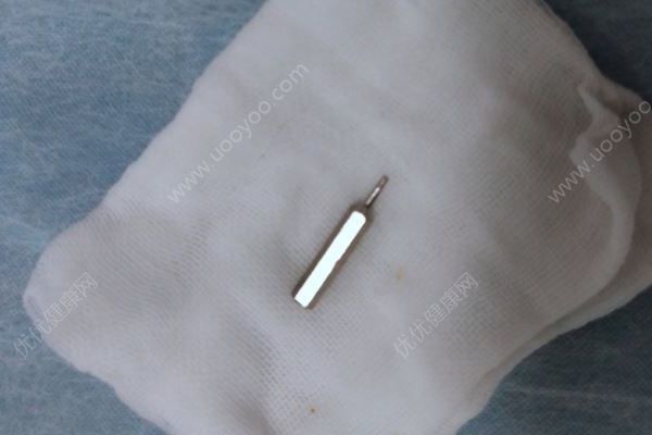 16个月男孩误吞螺丝刀头，2小时手术异物安全取出(4)