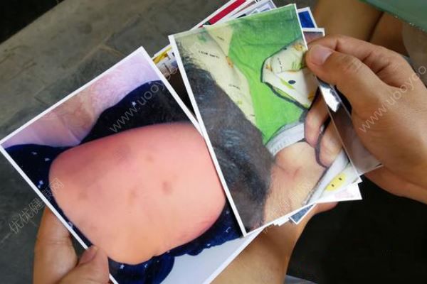 幼儿园内男童遭老师“背摔”，园方：当事老师解聘(1)