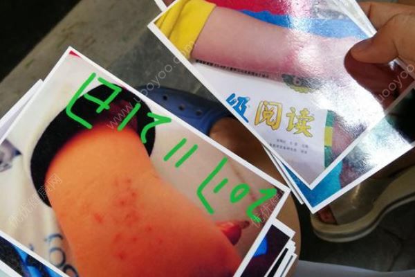 幼儿园内男童遭老师“背摔”，园方：当事老师解聘(2)