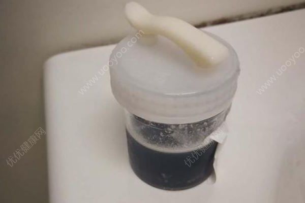 老人把百草枯当酱油做红烧肉，一家四口仅孙子没吃(1)